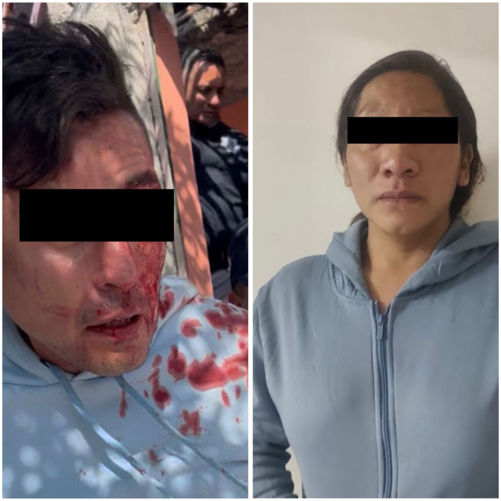 Rescata policía de Ecatepec a bebé que fue golpeado por su padre